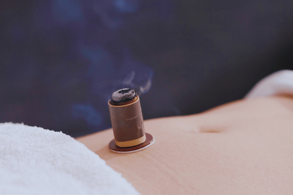 Direct Moxibustion Treatment