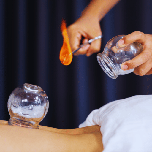 Fire Cupping