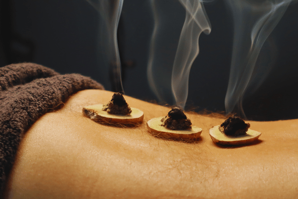 Indirect Moxibustion