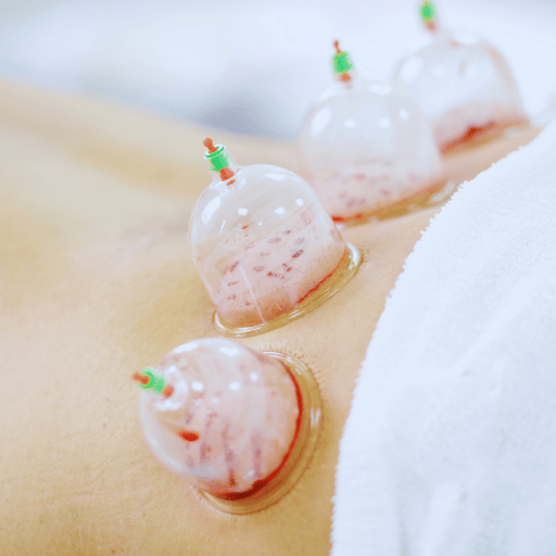 Wet Cupping / Hijama
