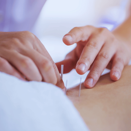 How Acupuncture Helps IVF — 4 Biological Mechanisms Explained