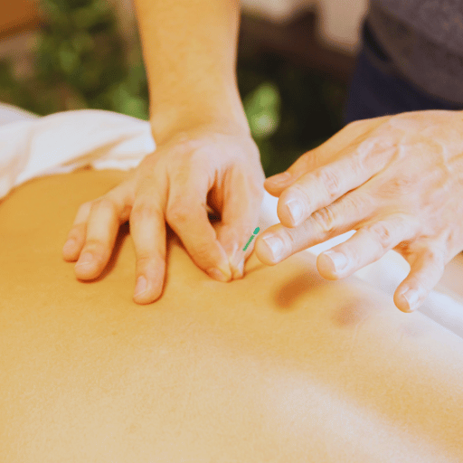 What Happens Before and After Embryo Transfer Acupuncture