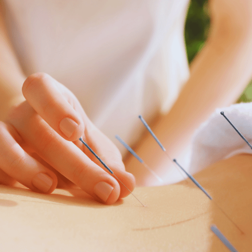 Drug-Free Alternatives — Acupuncture, Acupressure, and Other Approaches