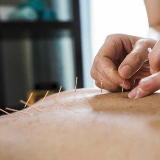 What Is Menopause — and When Does It Actually Start?