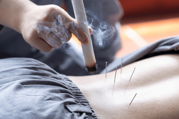 Moxibustion Treatment