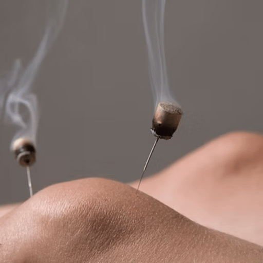 The Short Answer: Where Acupuncture Works and Where It Doesn't