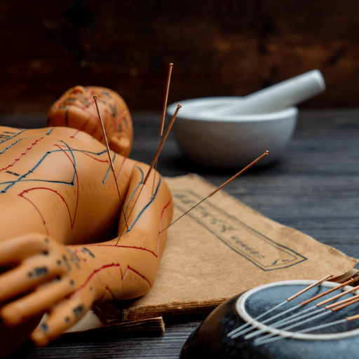 What Is Acupuncture? A 2,500-Year-Old TCM Practice