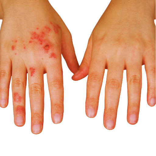 Acupuncture and Complementary Therapies — Points, Mechanisms, Evidence