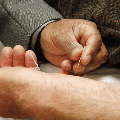Where Acupuncture Research Is Heading