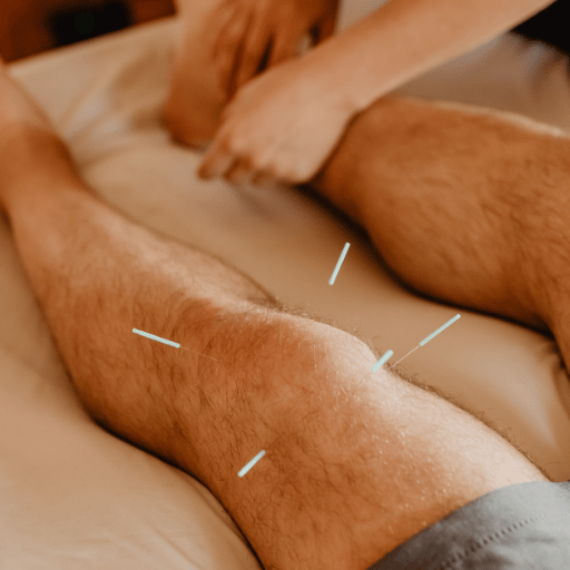 Industry Outlook 2025–2026: Where Needle Therapy Is Heading