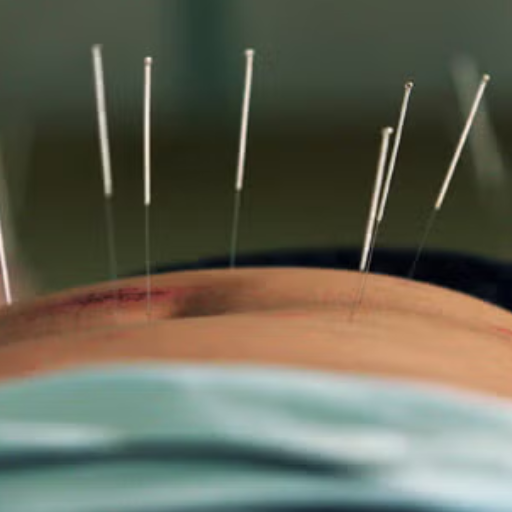 Fertility Acupuncture in 2026: Where the Evidence Is Heading