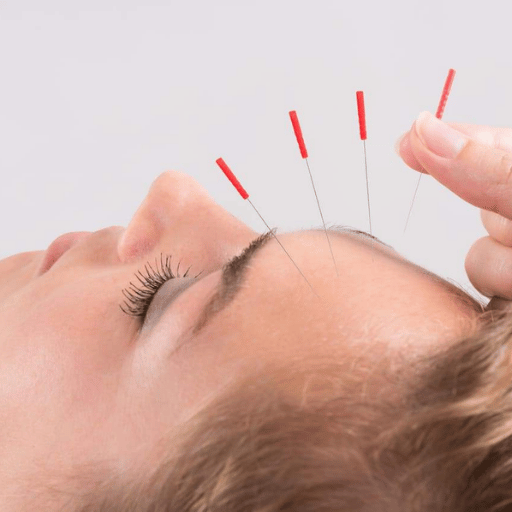 Safety, Side Effects & What to Ask a Qualified Acupuncturist