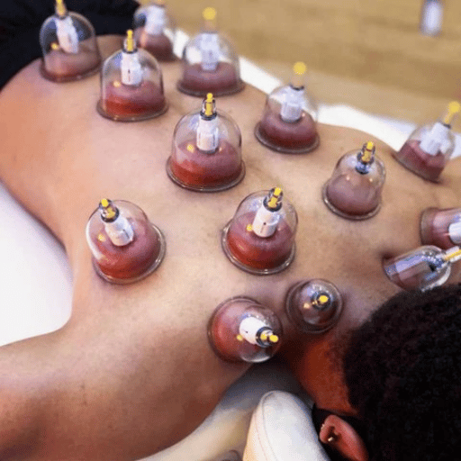 Modern Cupping Therapy: Dry, Wet, Fire & Facial Methods Explained