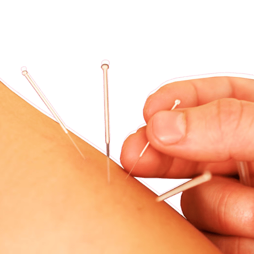 How Acupuncture Works: Two Frameworks That Don't Always Agree