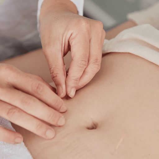 Four Mechanisms by Which Acupuncture May Influence IVF Outcomes
