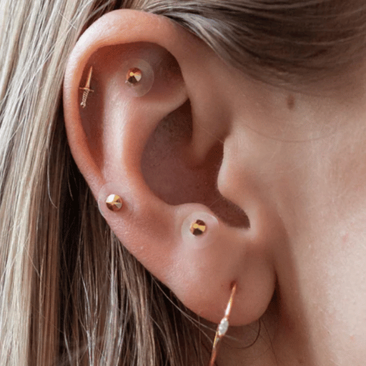 What Are Ear Seeds, and Why Are People Using Them for Weight Loss?