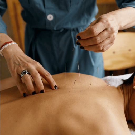 What a Typical Acupuncture Course Looks Like, Week by Week