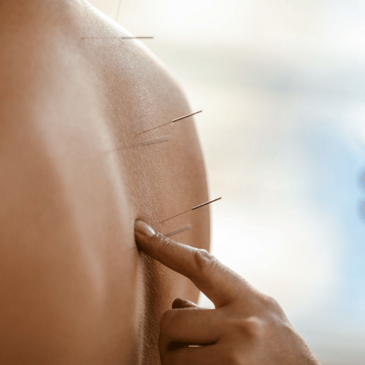 How Acupuncture Relieves Lower Back Pain — The Mechanism
