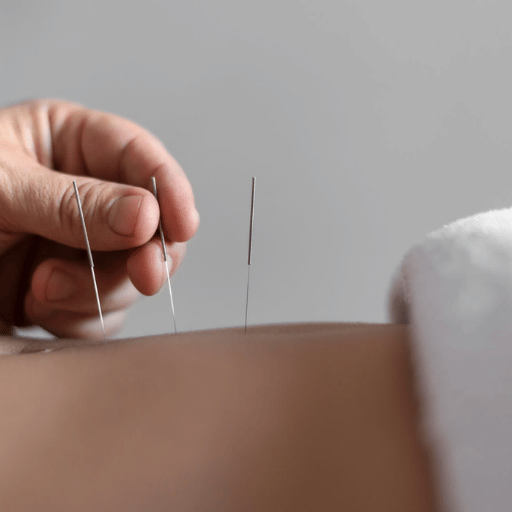 Does Acupuncture Hurt the First Time? What to Expect in Session One