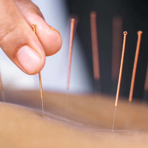 How Does Fertility Acupuncture Work? Three Documented Mechanisms