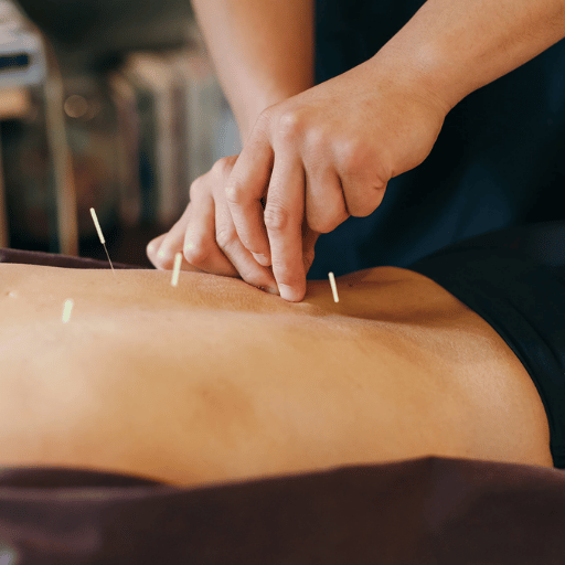 Acupuncture vs Ozempic at a Glance