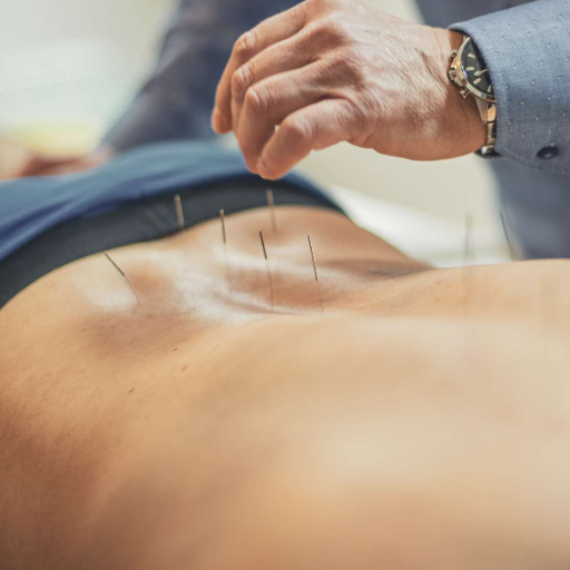 How Acupuncture Works for Back Pain — Mechanisms Backed by Science