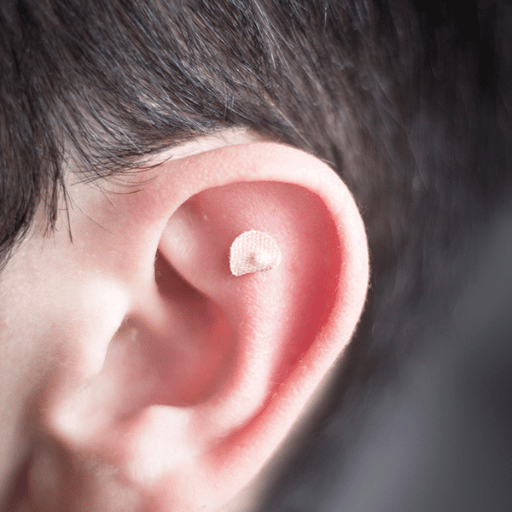 Body Points vs. Ear (Auricular) Points: Which Works Better?