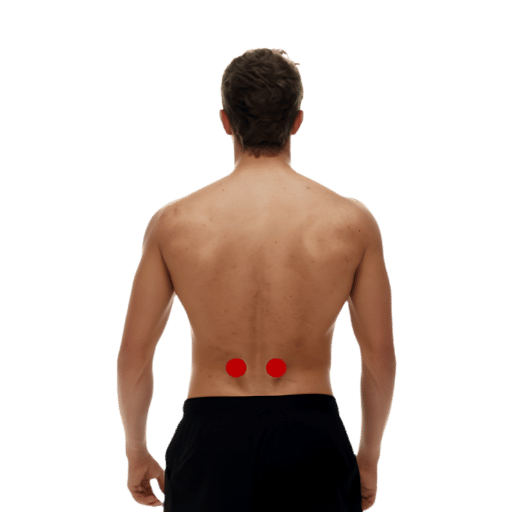 Key Acupuncture Points Used for Back Pain