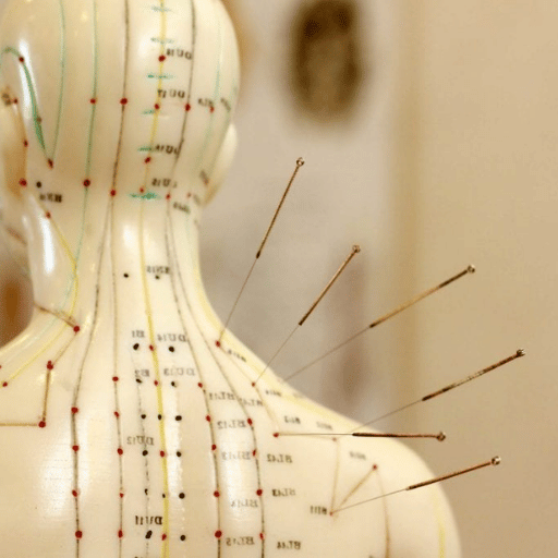 Where Is the Most Painful Place to Get Acupuncture? Body-Region Sensitivity Map