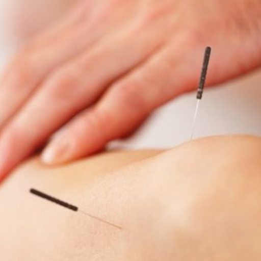 Does Fertility Acupuncture Work? What the Evidence Actually Shows