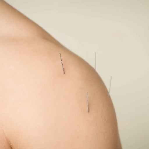 Traditional Chinese Medicine for Shoulder Pain: Evidence and Methods