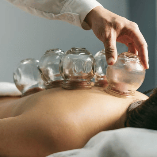 What to Expect During a Cupping Session