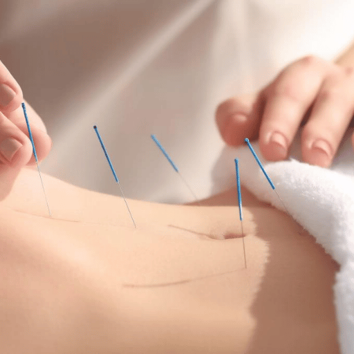 What to Expect — Your First Acupuncture Session for Lower Back Pain