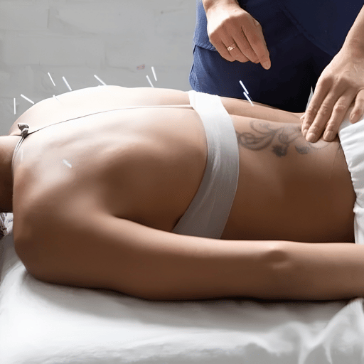 What to Expect: A Typical Acupuncture Session for Back Pain