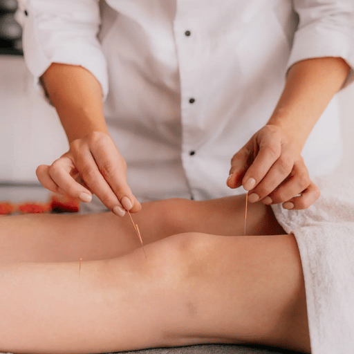 What Happens at an Acupuncture Session (And What It Feels Like)