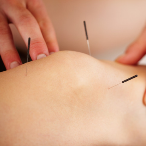 Traditional Chinese Medicine & Alternative Treatments for Knee Pain
