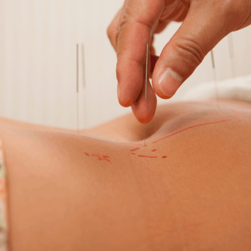 Which Fertility Conditions Does Acupuncture Help?