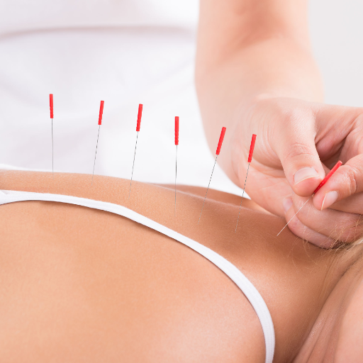 Acupuncture vs. Chiropractic, Massage, and Medication — How They Compare
