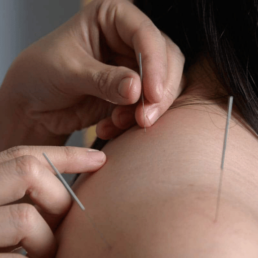 How to Reduce the Risk of Flare-Ups — Patient-Side Checklist