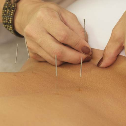 Fertility Acupuncture and IVF: A Stage-by-Stage Protocol