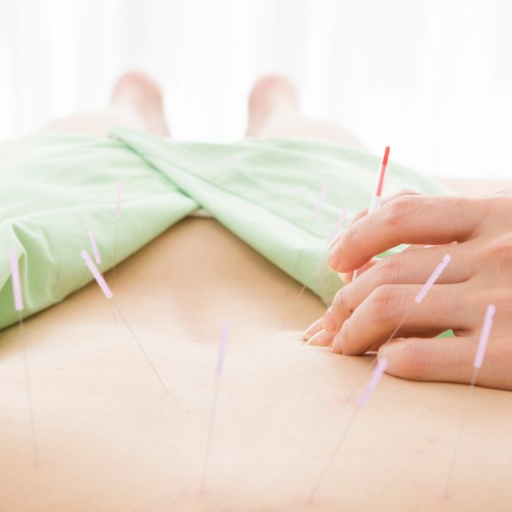 What to Expect During Your First Acupuncture Session