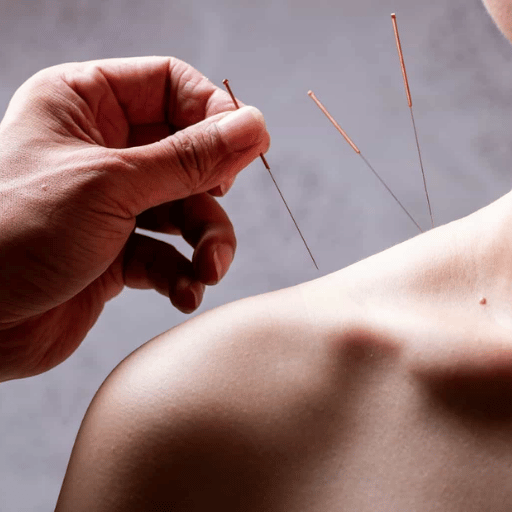 Safety, Side Effects, and Who Should Avoid Acupuncture