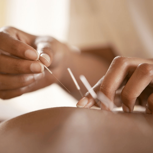 Safety, Side Effects & Who Should Avoid Acupuncture