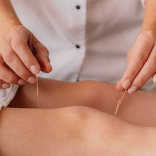 The 90-Day Fertility Window: When to Start Acupuncture