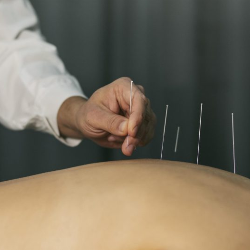 Safety, Side Effects, and When to Avoid Acupuncture