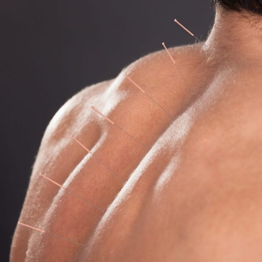 Traditional Chinese Medicine and Back Pain — The Whole-Body Approach
