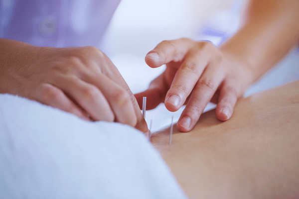 Acupuncture for Depression