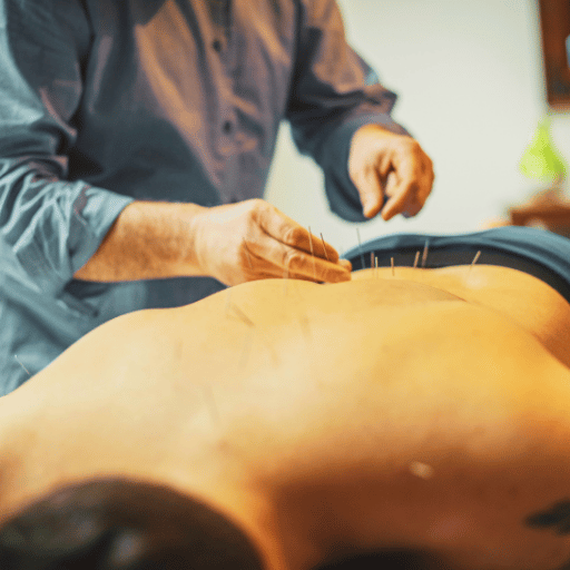 Male Fertility Acupuncture