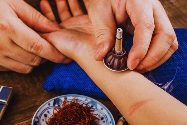 Moxibustion Treatment for Tenosynovitis