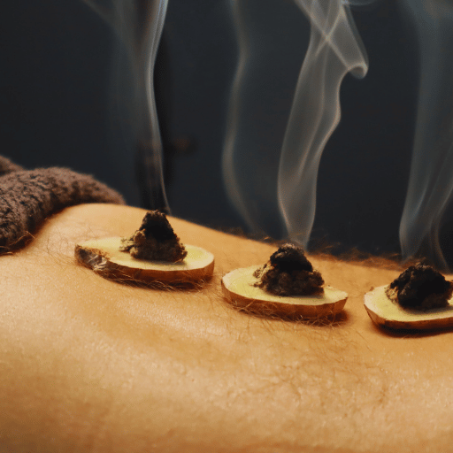 TCM Moxibustion